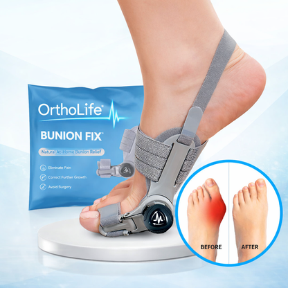 OrthoLife™ Bunion Fix